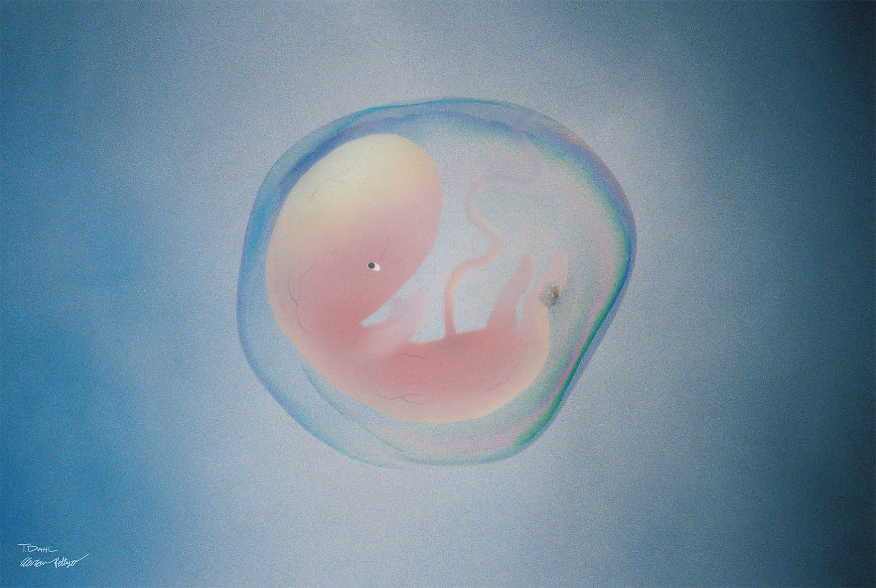Embryo